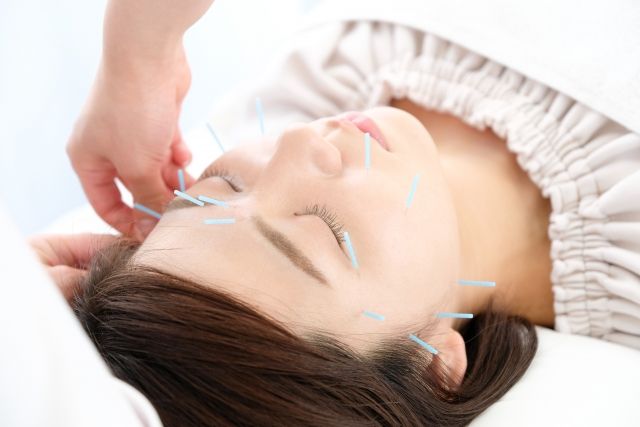美容鍼 - 刈谷市で美容鍼の施術のことなら「G&Oアキュパンクチュア鍼灸院」